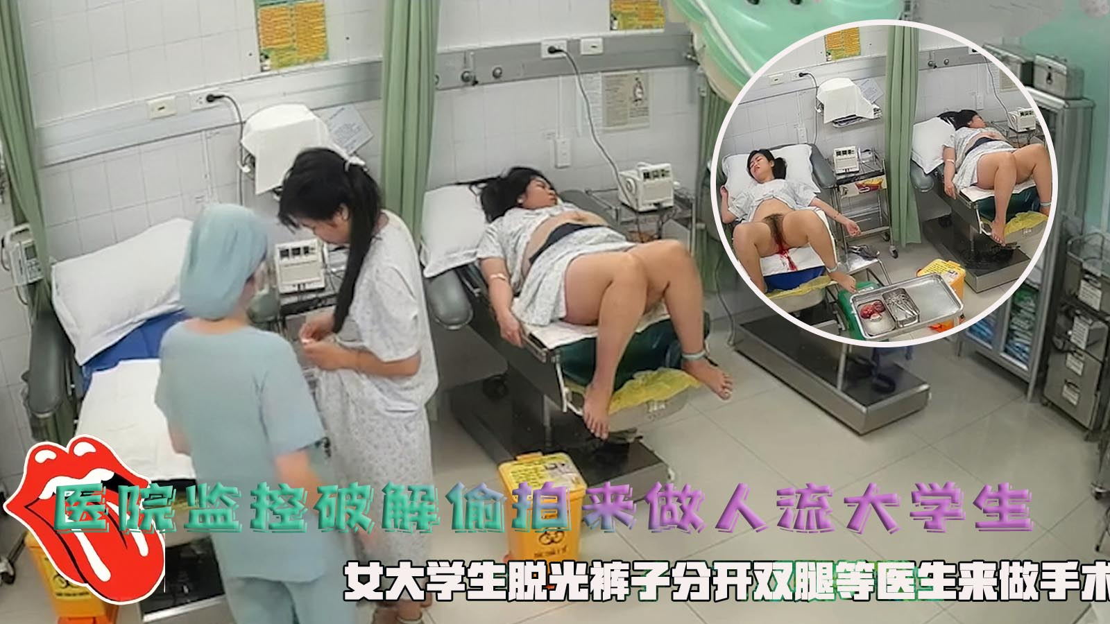 医院监控破解偷拍来做人流大学生，女大学生脱光裤子分˙开双腿等医生来做手术。